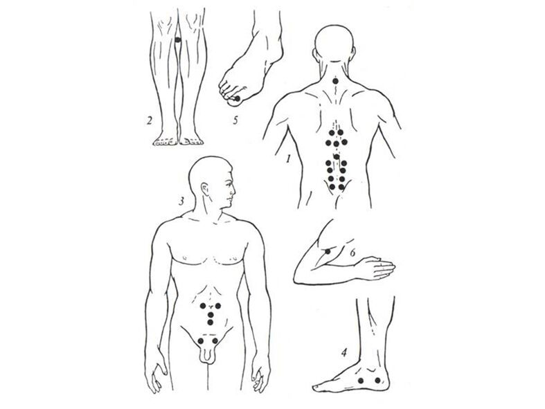 Acupuncture treatment massage